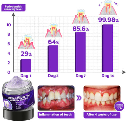 🎁Flash Sale - Don’t Miss Out - BBOJI™  TeethRestoration Mineral Powder🦷(TGA recommended)👩‍⚕️(Treats periodontitis and mouth ulcers, prevents tooth loss, and repairs gum recession)